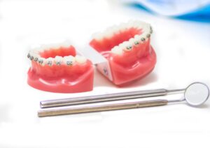 Dentysta – jak wygląda pierwsza wizyta i na co się przygotować