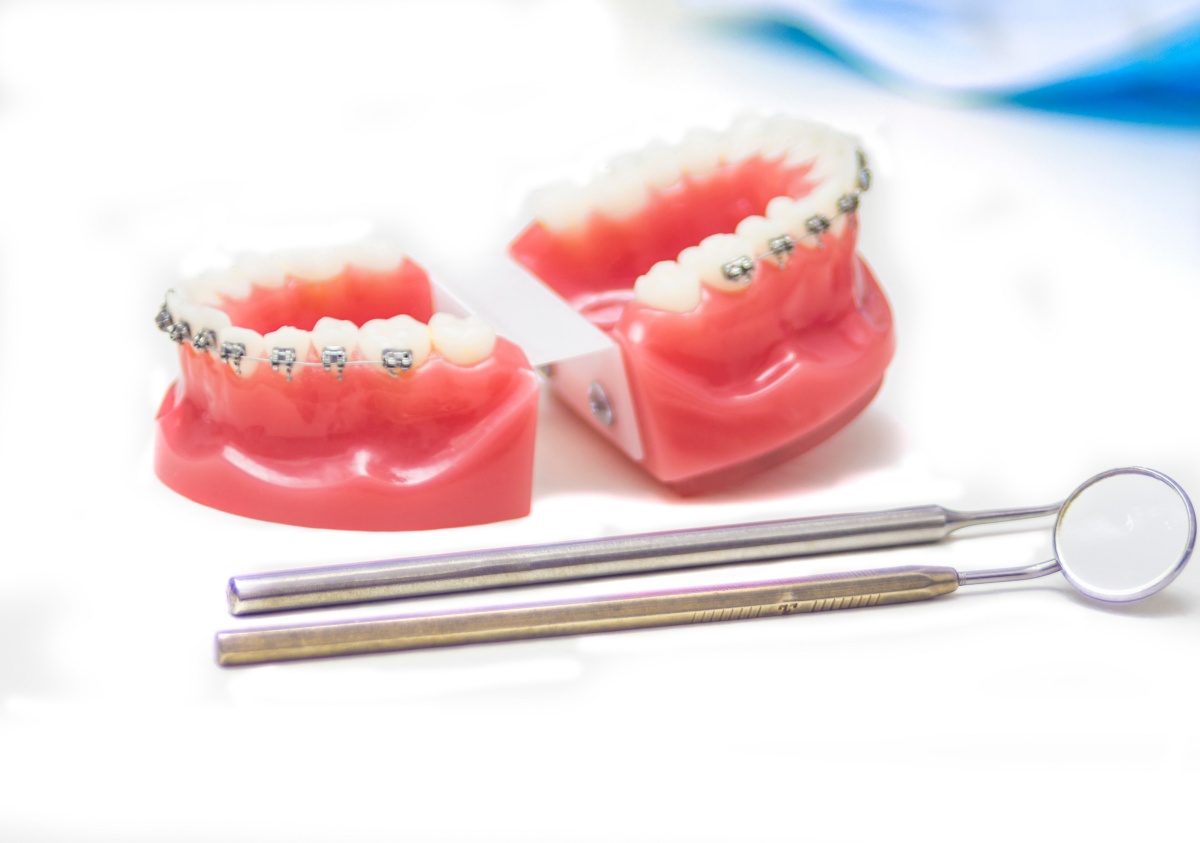 Dentysta – jak wygląda pierwsza wizyta i na co się przygotować